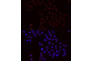 Immunofluorescence analysis of HeLa cells using BCL2 antibody (ABIN6135189, ABIN6136024, ABIN6136025 and ABIN6225596) at dilution of 1:100 (40x lens). (Bcl-2 antibody  (pSer70))