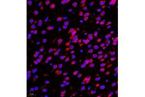 Immunofluorescence of paraffin embedded mouse brain using DMD (ABIN7073791) at dilution of 1:650 (400x lens) (Dystrophin antibody)