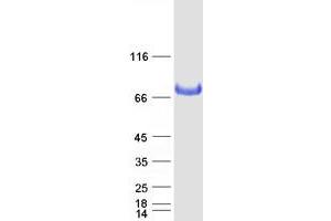 Validation with Western Blot (Butyrylcholinesterase Protein (BCHE) (Myc-DYKDDDDK Tag))