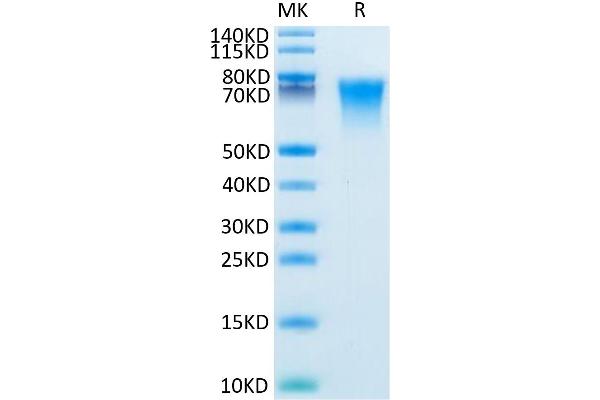 IBSP Protein (AA 17-324) (His tag)