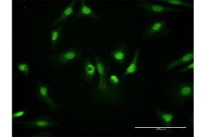 Immunofluorescence of monoclonal antibody to PKM2 on HeLa cell. (PKM2 antibody  (AA 436-531))