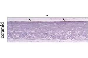 Sections of 3D organotypic skin equivalents were stained for ceramide. (Ceramide antibody)