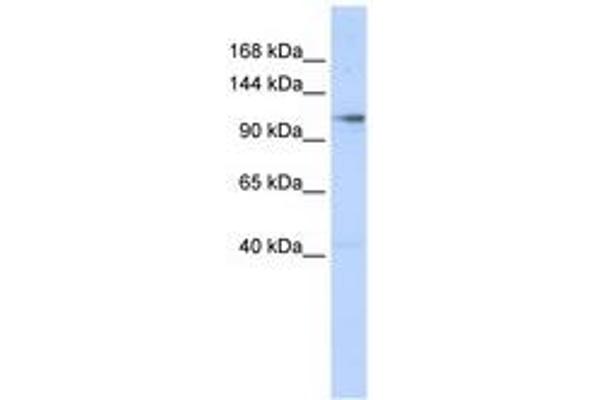 ZMIZ1 antibody  (N-Term)