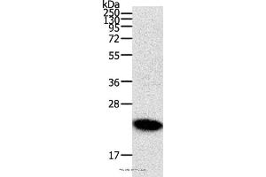 Western blot analysis of Human fetal brain tissue, using RHOC Polyclonal Antibody at dilution of 1:300 (RHOC antibody)