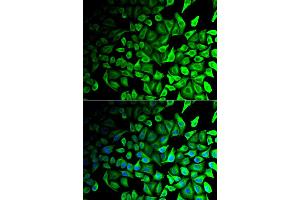 Immunofluorescence analysis of HeLa cells using DPP7 antibody (ABIN5973952). (DPP7 antibody)