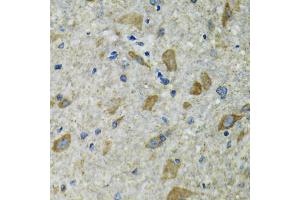 Immunohistochemistry of paraffin-embedded mouse spinal cord using TXN2 antibody. (TXN2 antibody)