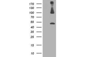 Western Blotting (WB) image for anti-Proteasome (Prosome, Macropain) 26S Subunit, Non-ATPase, 2 (PSMD2) antibody (ABIN1500483) (PSMD2 antibody)