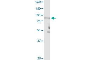 C1R MaxPab rabbit polyclonal antibody. (C1R antibody  (AA 1-705))