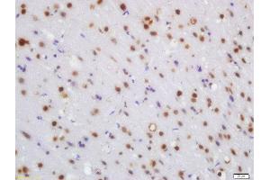 Formalin-fixed and paraffin embedded rat brain labeled with Rabbit Anti-WRB Polyclonal Antibody, Unconjugated (ABIN1387386) at 1:200 followed by conjugation to the secondary antibody and DAB staining (WRB antibody  (AA 71-174))