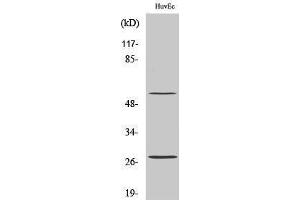 Western Blotting (WB) image for anti-CD69 (CD69) (Internal Region) antibody (ABIN3183782) (CD69 antibody  (Internal Region))
