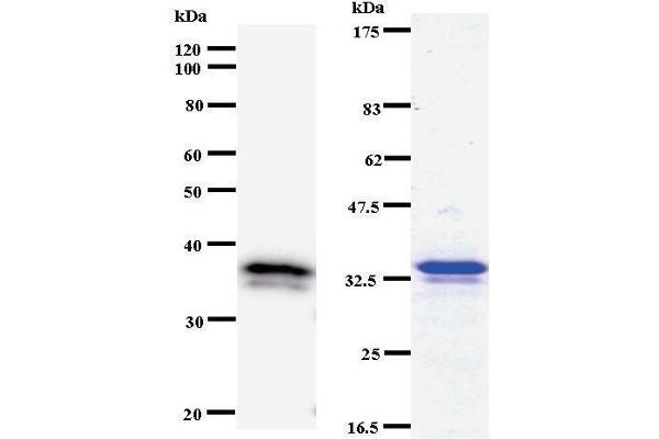 DHX38 antibody