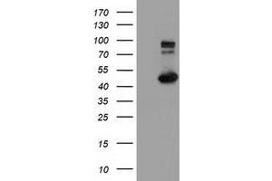 Western Blotting (WB) image for anti-Intraflagellar Transport 57 Homolog (IFT57) antibody (ABIN1498810) (IFT57 antibody)