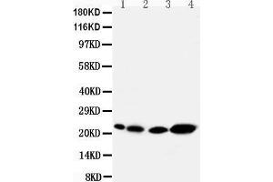 Anti-Caveolin-2 antibody, Western blotting Lane 1: Rat Heart Tissue Lysate Lane 2: Rat lung Tissue Lysate Lane 3: HELA Cell Lysate Lane 4: A431 Cell Lysate (Caveolin 2 antibody  (N-Term))