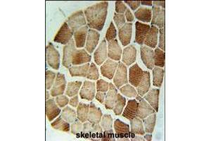 STX7 Antibody immunohistochemistry analysis in formalin fixed and paraffin embedded human skeletal muscle followed by peroxidase conjugation of the secondary antibody and DAB staining. (Syntaxin 7 antibody  (N-Term))