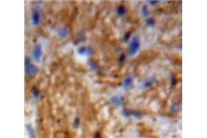 IHC-P analysis of Brain tissue, with DAB staining. (Neurotrophin 3 antibody  (AA 21-138))