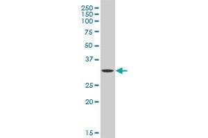 HAX1 polyclonal antibody (A01), Lot # 051109JC01 Western Blot analysis of HAX1 expression in MES-SA/Dx5 . (HAX1 antibody  (AA 1-279))