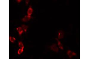 ABIN6274436 staining HepG2 by IF/ICC. (COQ8A antibody)