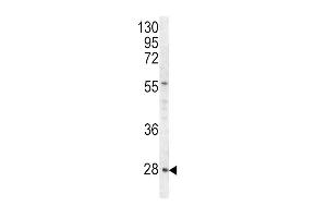 Western blot analysis of HPRT1 antibody in Hela cell line lysates (35ug/lane) (HPRT1 antibody  (C-Term))