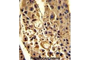 Immunohistochemistry (IHC) image for anti-Complement Factor H-Related 1 (CFHR1) antibody (ABIN3002714) (CFHR1 antibody)