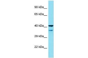 Host: Rabbit Target Name: MAPKAPK2 Sample Type: A549 Whole Cell lysates Antibody Dilution: 1. (MAPKAP Kinase 2 antibody  (C-Term))