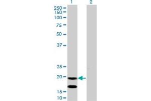 Western Blot analysis of EMP3 expression in transfected 293T cell line by EMP3 monoclonal antibody (M01), clone 3D4. (EMP3 antibody  (AA 1-163))