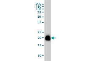 RHOA monoclonal antibody (M08), clone 1C3 Western Blot analysis of RHOA expression in A-431 . (RHOA antibody  (AA 1-193))