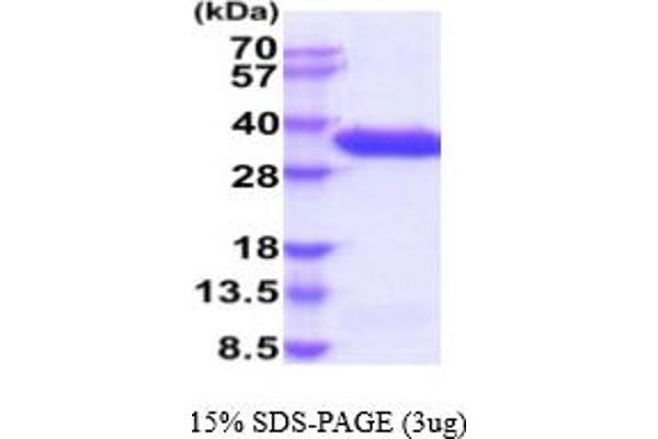 Complement Factor B Protein (CFB) (AA 26-259) (His tag)