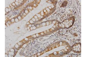 Immunoperoxidase of monoclonal antibody to MAPK13 on formalin-fixed paraffin-embedded human small Intestine. (MAPK13 antibody  (AA 251-365))