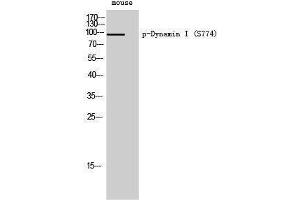 Western Blotting (WB) image for anti-Dynamin 1 (DNM1) (pSer774) antibody (ABIN3182513) (Dynamin 1 antibody  (pSer774))