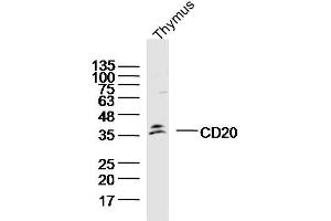 Mouse thymus lysates probed with CD20 Polyclonal Antibody, Unconjugated (bs-20639R) at 1:300 overnight at 4˚C. (CD20 antibody  (AA 151-250))