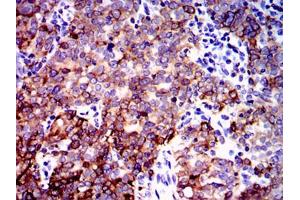 Immunohistochemistry (IHC) image for anti-Protein Phosphatase 2A Activator, Regulatory Subunit 4 (PPP2R4) antibody (ABIN969557)