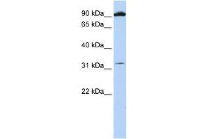 GRM6 antibody used at 0. (Metabotropic Glutamate Receptor 6 antibody  (N-Term))