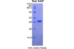 SDS-PAGE analysis of Rat SAP Protein. (APCS Protein)