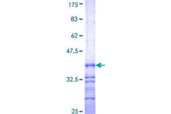 HAO1 Protein (AA 1-100) (GST tag)