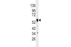 Western Blotting (WB) image for anti-Dual Specificity Phosphatase 4 (DUSP4) antibody (ABIN3003764) (DUSP4 antibody)