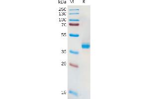 Human A11 Protein, hFc Tag on SDS-PAGE under reducing condition. (SLC7A11 Protein (AA 67-74) (Fc Tag))