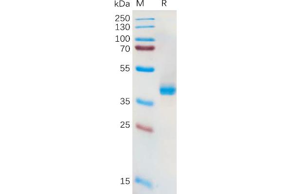 SLC7A11 Protein (AA 67-74) (Fc Tag)