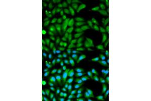 Immunofluorescence analysis of HeLa cells using PARK2 antibody (ABIN5970356). (Parkin antibody)