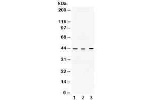 Western blot testing of 1) rat heart, 2) human HepG2 and 3) human A549 lysate with VEGFD antibody. (VEGFD (VEGF4) (AA 89-205) antibody)