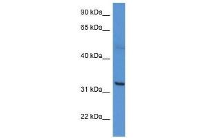 Western Blot showing CA5A antibody used at a concentration of 1-2 ug/ml to detect its target protein. (CA5A antibody  (C-Term))