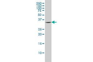 FCER1A monoclonal antibody (M01), clone 2C12-3B6 Western Blot analysis of FCER1A expression in A-549 . (Fc epsilon RI/FCER1A antibody  (AA 1-257))