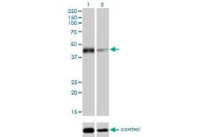Western blot analysis of SIRT2 over-expressed 293 cell line, cotransfected with SIRT2 Validated Chimera RNAi (Lane 2) or non-transfected control (Lane 1). (SIRT2 antibody  (AA 128-227))