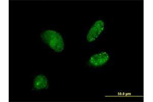 Immunofluorescence of purified MaxPab antibody to DCTN3 on HeLa cell. (DCTN3 antibody  (AA 1-176))