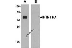 Western Blotting (WB) image for anti-Hemagglutinin antibody (Influenza A Virus H1N1) (ABIN1031792) (Hemagglutinin antibody)