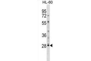 Western Blotting (WB) image for anti-Lymphocyte Antigen 6 Complex, Locus G6F (LY6G6F) antibody (ABIN2999007) (LY6G6F antibody)