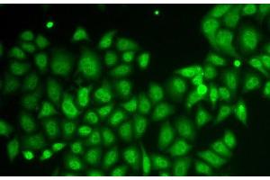 Immunofluorescence analysis of HeLa cells using AKR1A1 Polyclonal Antibody (AKR1A1 antibody)
