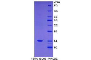 SDS-PAGE (SDS) image for Family with Sequence Similarity 19 (Chemokine (C-C Motif)-Like), Member A3 (FAM19A3) (AA 44-130) protein (His tag) (ABIN2124761) (FAM19A3 Protein (AA 44-130) (His tag))