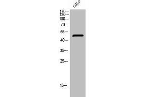 Western Blot analysis of COLO cells using Phospho-PTP1B (S50) Polyclonal Antibody (PTPN1 antibody  (pSer50))