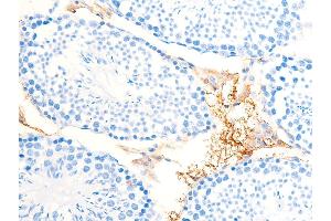 ABIN6267222 at 1/100 staining mouse testicular tissue sections by IHC-P. (CHEK1 antibody  (pSer286))