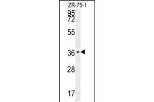 Western blot analysis in ZR-75-1 cell line lysates (35ug/lane). (CLEC12A antibody  (AA 178-206))